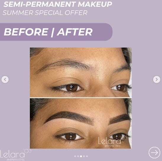 Microblading